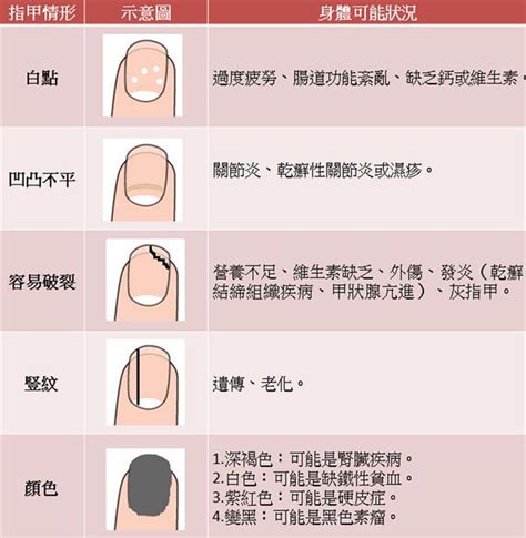 腳指甲內凹|指甲上有白點、凹溝暗示什麼疾病？最完整！15個指甲。